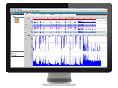 ResScan patient therapy management software ResMed